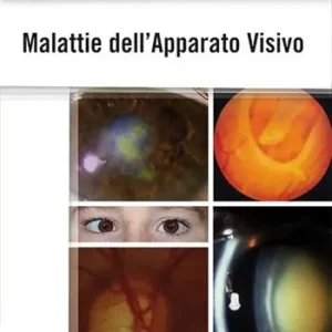 Malattie dell‘apparato visivo Prezzo Basso