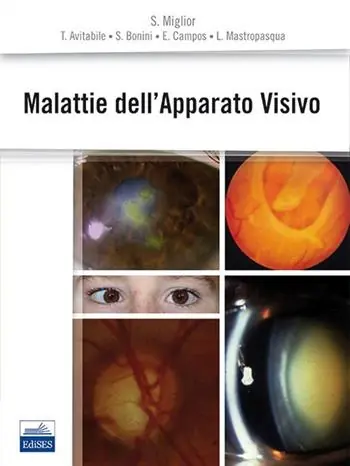 Malattie dell‘apparato visivo Prezzo Basso
