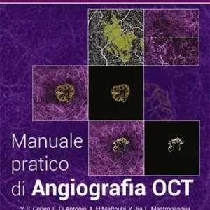 Occasione Imperdibile Manuale pratico di angiografia OCT