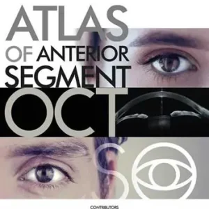 Scelto Dai Clienti Atlas of anterior segment oct