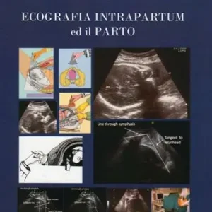 Scelto Dai Clienti Ecografia intrapartum ed il parto
