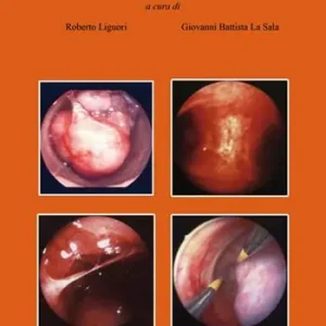 Esclusivo La chirurgia isteroscopica oggi. Tecnologia e realtà. Con DVD