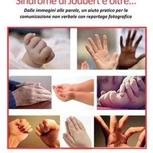 Direttamente Dal Produttore Sindrome di Joubert e oltre... Dalle immagini alle parole, un aiuto pratico per la comunicazione non verbale con reportage fotografico. Ediz. illustrata