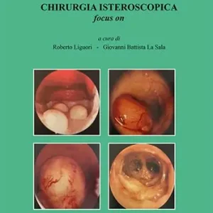 Chirurgia isteroscopica focus on Ultime Pezzi